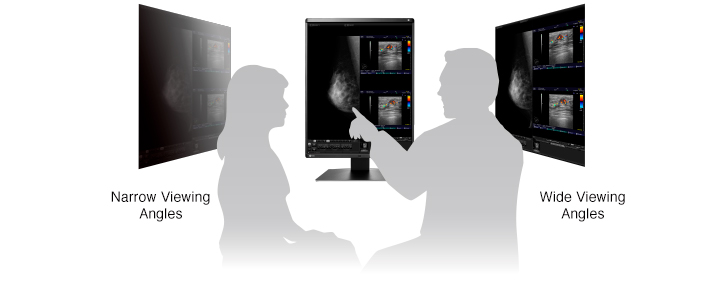 Monitor medyczny EIZO RadiForce RX560-BK